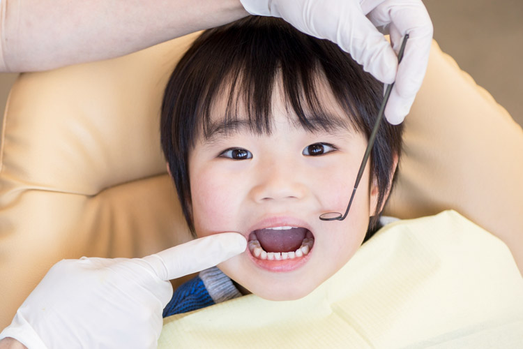 小児矯正歯科画像
